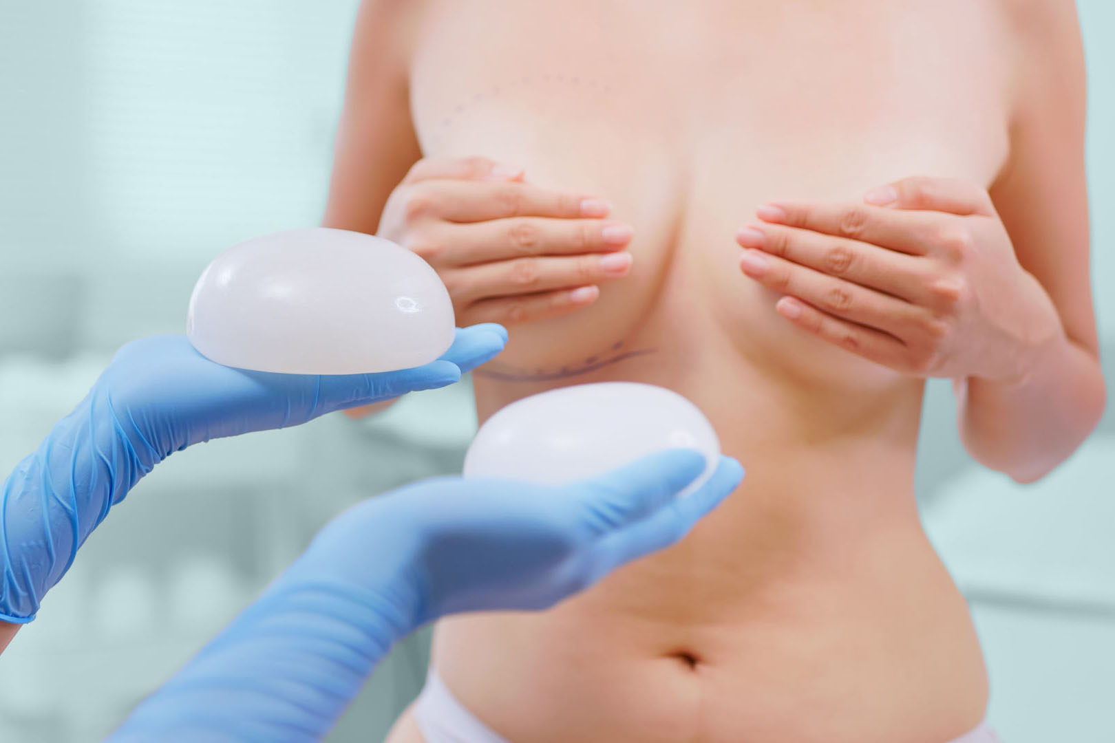 Implants mammaires Lyon augmentation poitrine Docteur Negulescu