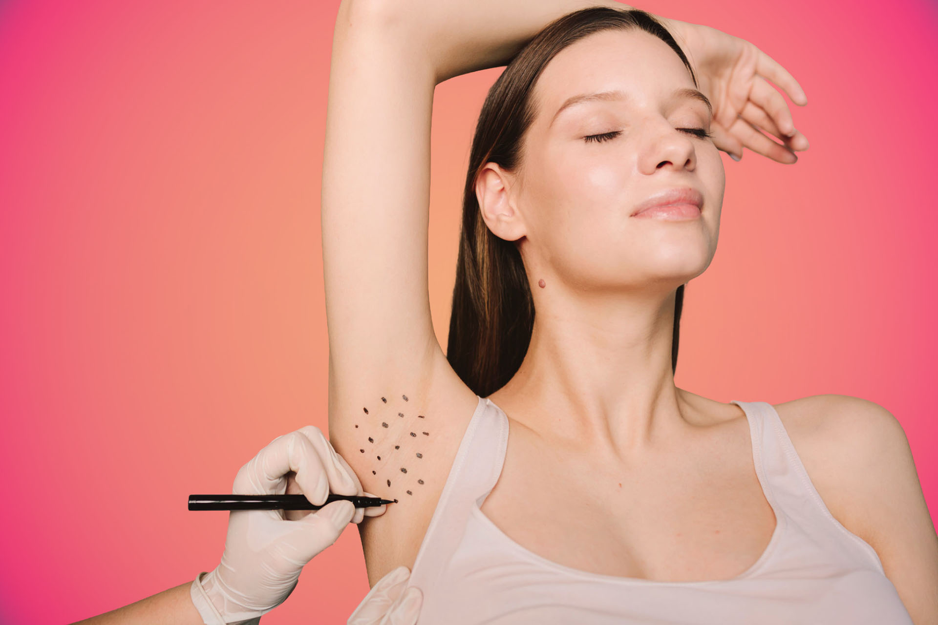 Traitement hyperhidrose à Lyon – injections de Botox transpiration excessive