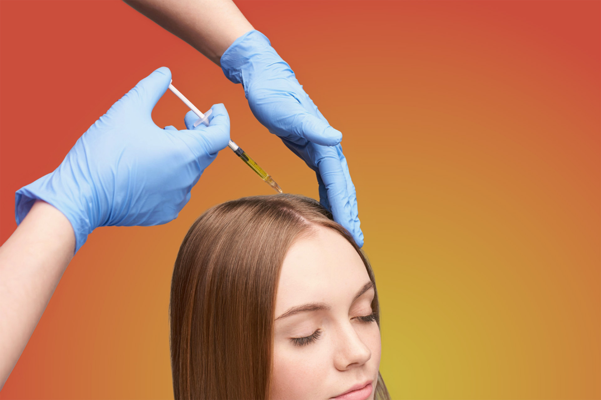 PRP cheveux à Lyon – injections plasma riche en plaquettes Docteur Negulescu